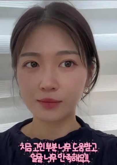 시술 후 백합님
