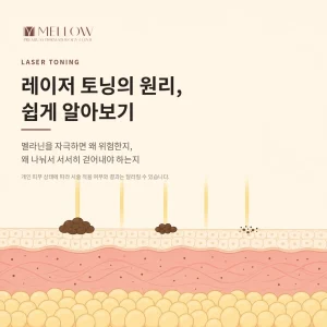 레이저 토닝의 원리, 쉽게 알아보기 #멜라닌