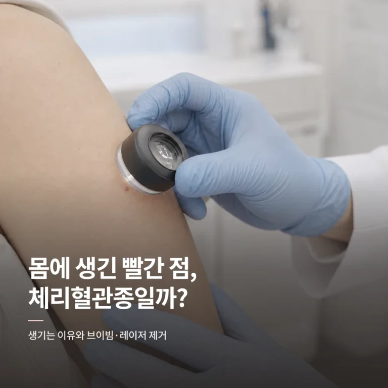 몸에 생긴 빨간 점, 체리혈관종일까? - 생기는 이유와 브이빔·레이저 제거
