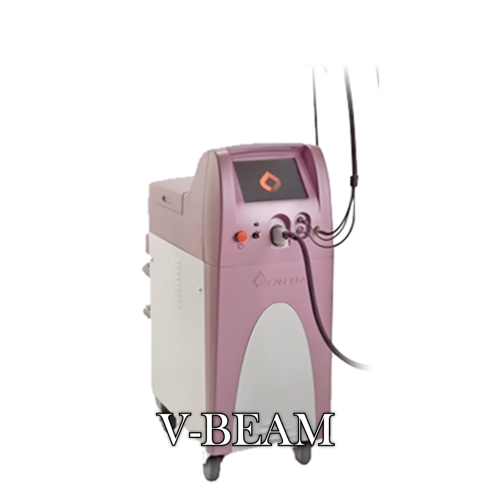 멜로우 V-Beam 장비