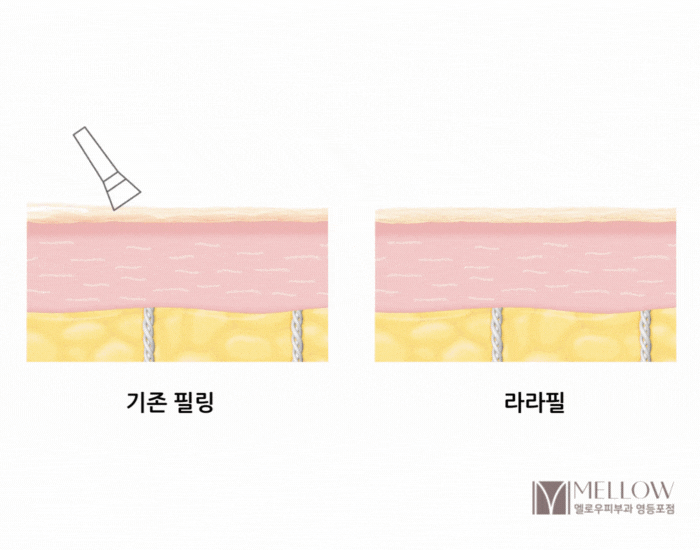스킨 스케일링