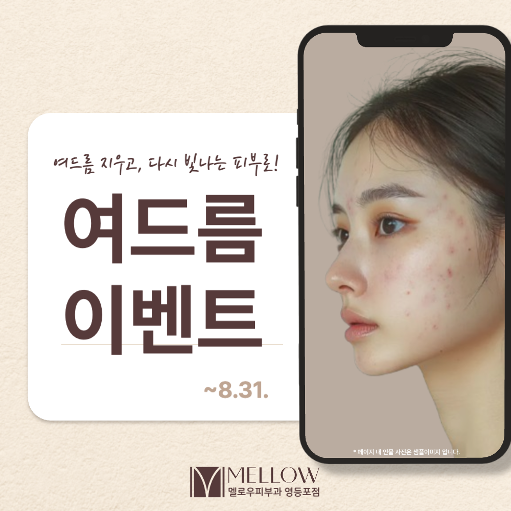 여드름 이벤트