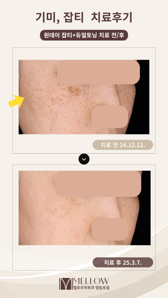 색소올인원