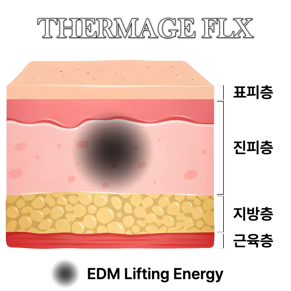 써마지