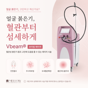 영등포 브이빔 레이저 치료 #홍조 #주사피부염